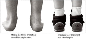 With and without the Cascade Dafo Chipmunk Orthotics