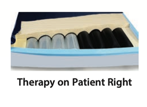 Span America AP2 Deluxe In-Home Therapy mattress with alternating pressure or lateral rotation, by flipping a switch.